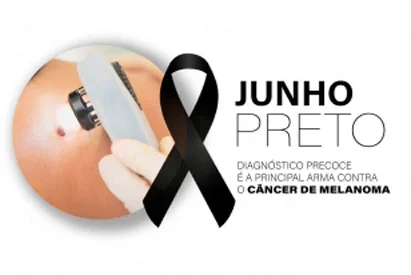 Diagnóstico precoce é decisivo no combate ao melanoma, alertam especialistas durante o Junho Preto